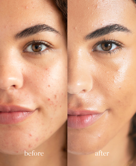 Ere Perez Corrector con Lichi Belleza Vegana | e367j