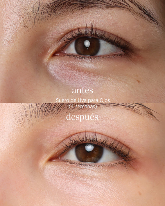 suero de uva para ojos