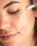 clear skin set