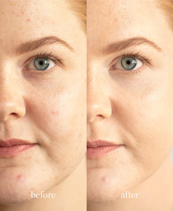 Ere Perez Corrector con Lichi Belleza Vegana | e367b