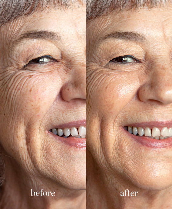 Ere Perez Corrector con Lichi Belleza Vegana | e367d